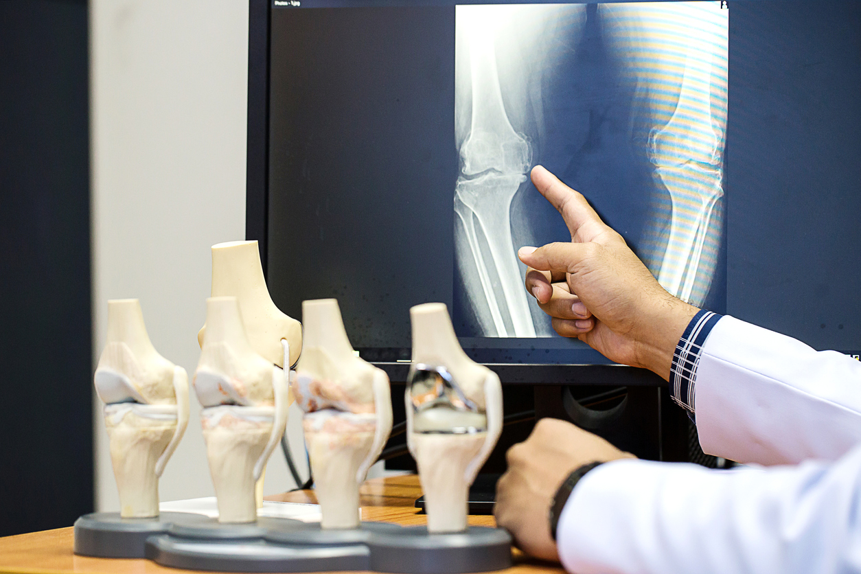 Orthopedic & Joint Replacement